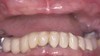lovely-smile-dental-care-photo-gallery-before-03