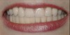 lovely-smile-dental-care-photo-gallery-after-04
