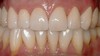lovely-smile-dental-care-photo-gallery-after-01
